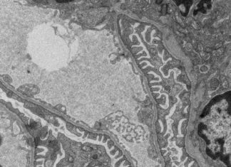 Scientists have identified an enzyme that if excessively suppressed, can trigger renal failure