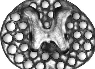 Spinal cord injury – 3-D printed implant promotes nerve cell growth