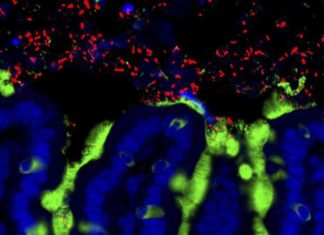 The intestinal bacteria of healthy newborns offer a new solution for treating food allergies