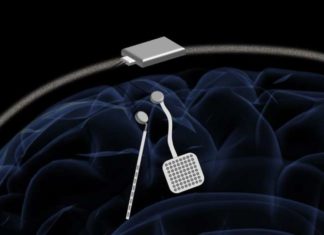 WAND : Wireless pacemaker for the brain could offer new treatment for neurological disorders