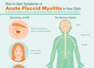 Acute Flaccid Myelitis : Pioneering Surgery Restores Movement