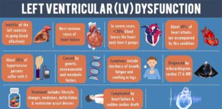 Asymptomatic left ventricular dysfunction : Study uses AI to create early detector of heart disease