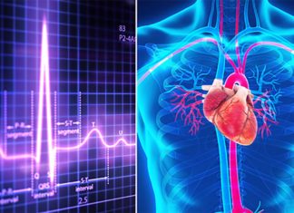 Researchers have found two biomarkers that identify the atrial fibrillation