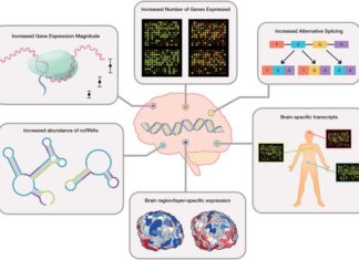 Scientists has discovered important clues to what goes wrong in the brains of people with autism