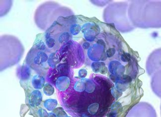 Sepsis : basophils play an important role