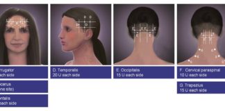 Botulinum toxin (Botox) injections can help to reduce the frequency of chronic migraines