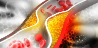 Consuming large quantities of rich Christmas food appears to boost cholesterol levels