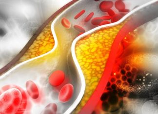 Consuming large quantities of rich Christmas food appears to boost cholesterol levels