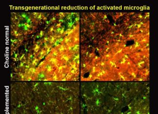 Choline may fight Alzheimer’s