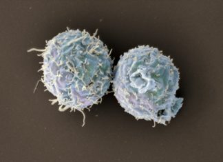 Researchers have discovered a molecular approach preventing rejection of the transplant maintaining the ability to fight against infections