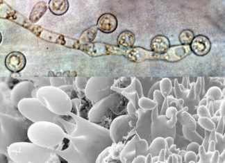 Fungal infections are emerging as a major medical challenge