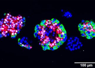 Future diabetes care: glucagon producing cells can change identity and produce insulin