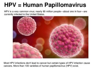 HPV-related head and neck cancers : novel biomarker appears predictive of outcome