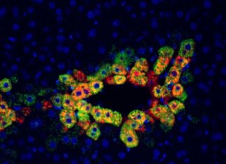 Researchers has identified a commonly used anti-rejection medication that could be repurposed to treat liver cancers