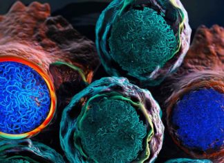 Researchers have identified characteristic epigenetic changes that can knock out leukemia