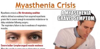 Surgery to remove the thymus gland in patients with myasthenia gravis (MG) provides significant clinical benefits as long as five years