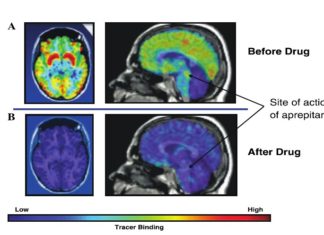 Why some drugs work particularly well to minimize the side effects of chemotherapy ?
