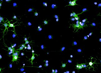 Multiple sclerosis – Researchers have discovered how the body try to repair any damage to sheath