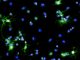 Multiple sclerosis – Researchers have discovered how the body try to repair any damage to sheath