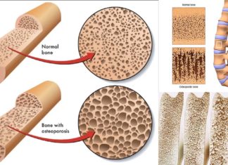 A cells deep in the brain may play a surprising role in controlling women’s bone density