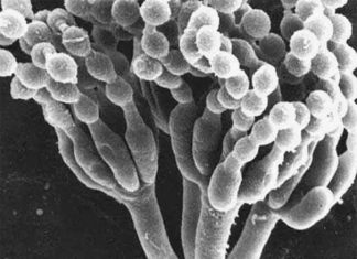 New recommendations for evaluation and management of penicillin allergy