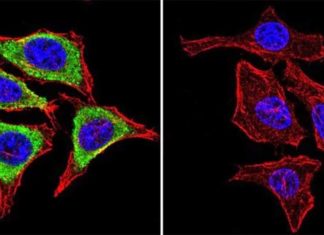 The researchers discovered the key protein GRP94 in insulin production