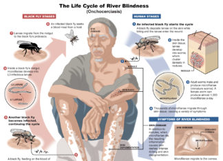 Developed new antibiotic that proves to be effective against river blindness