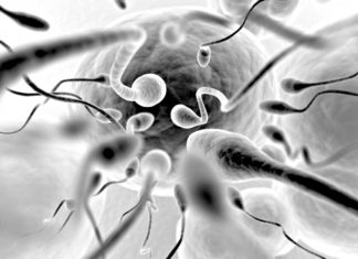 Found link between recurrent miscarriage and faulty sperm
