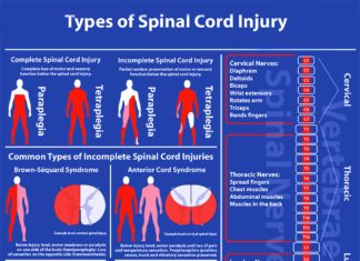 Spinal cord injuries : little is known about why these injuries