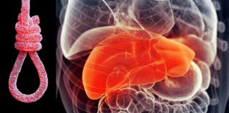 Fatty liver disease in children : Diet low in added sugars significantly improves the health