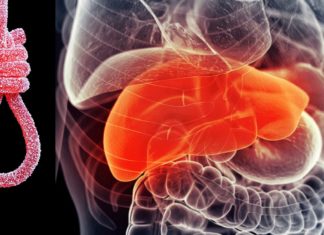 Fatty liver disease in children : Diet low in added sugars significantly improves the health