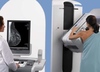 Thousands of younger women with no known risk of breast cancer get mammograms before having breast reduction surgery
