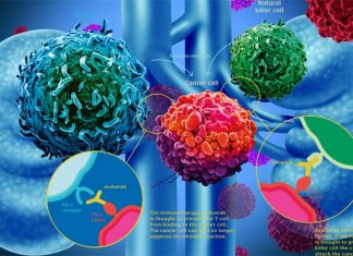 A combination of two drugs could become a new standard to treating patients with metastatic kidney cancer