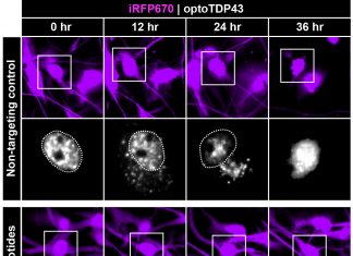 A single misbehaving protein is behind 97 percent of amyotrophic lateral sclerosis (ALS)