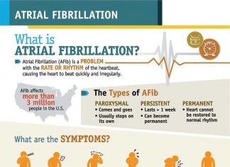 Atrial fibrillation (AF) : majority of triggers for irregular heartbeat can be avoided changing lifestyle
