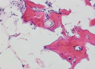 Researchers have uncovered two types of cells taht may help speed bone repair