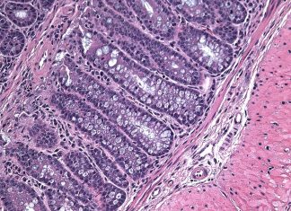 Cellular death is vital for health