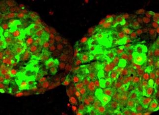 UC San Francisco researchers have for the first time transformed human stem cells into mature insulin-producing cells