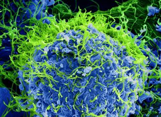 Ebola: the infected patients who survive have a much higher number of PC lipids