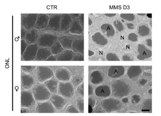 DNA repair can become harmful to cells, provoking an inflammatory response that produces severe tissue damage