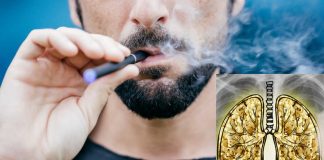 Electronic cigarette use (vaping) is associated with wheezing in adults