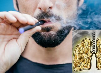 Electronic cigarette use (vaping) is associated with wheezing in adults