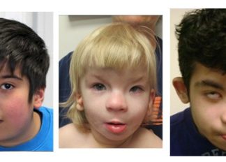 Geneticists discovered a potential therapy targeting for a severe autism-related disorder