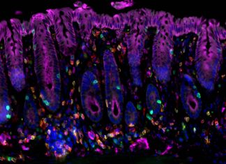 Interaction between immune factor IL-33 and regulatory T cells triggers cancer-promoting chronic inflammation