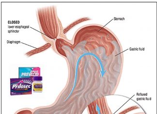 Kidney disease increases from common acid reflux medications