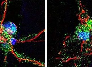 Brain protein UCHL1 may be critical to nerve cells repair after stroke damage