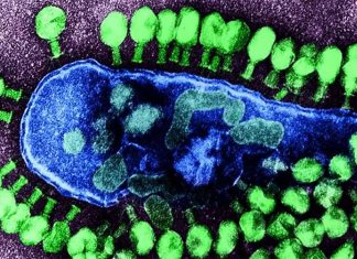 New technique to treat Crohn’s disease