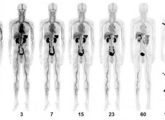 Acute venous thromboembolism : PET/CT imaging agent shows promise for better diagnosis