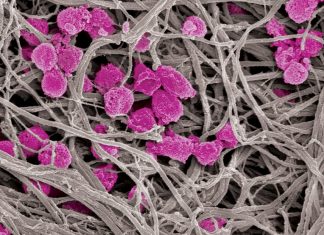 Reversible antiplatelet therapy offer a potential drug against Clots and Cancer
