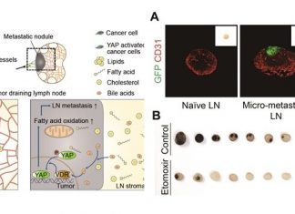 Researchers have revealed a mechanism to suppress the growth and spread of cancer cells in lymph nodes